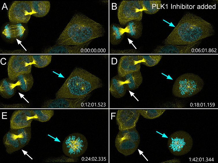 Câncer de Mama: O Citrato Citosólico Inicia a Reprogramação do Metabolismo Celular