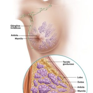 Câncer de Mama: Contribuição do GLUT3 para a Reprogramação Metabólica no Câncer de Mama